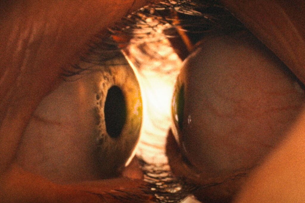 Two eyeballs millimetres apart.